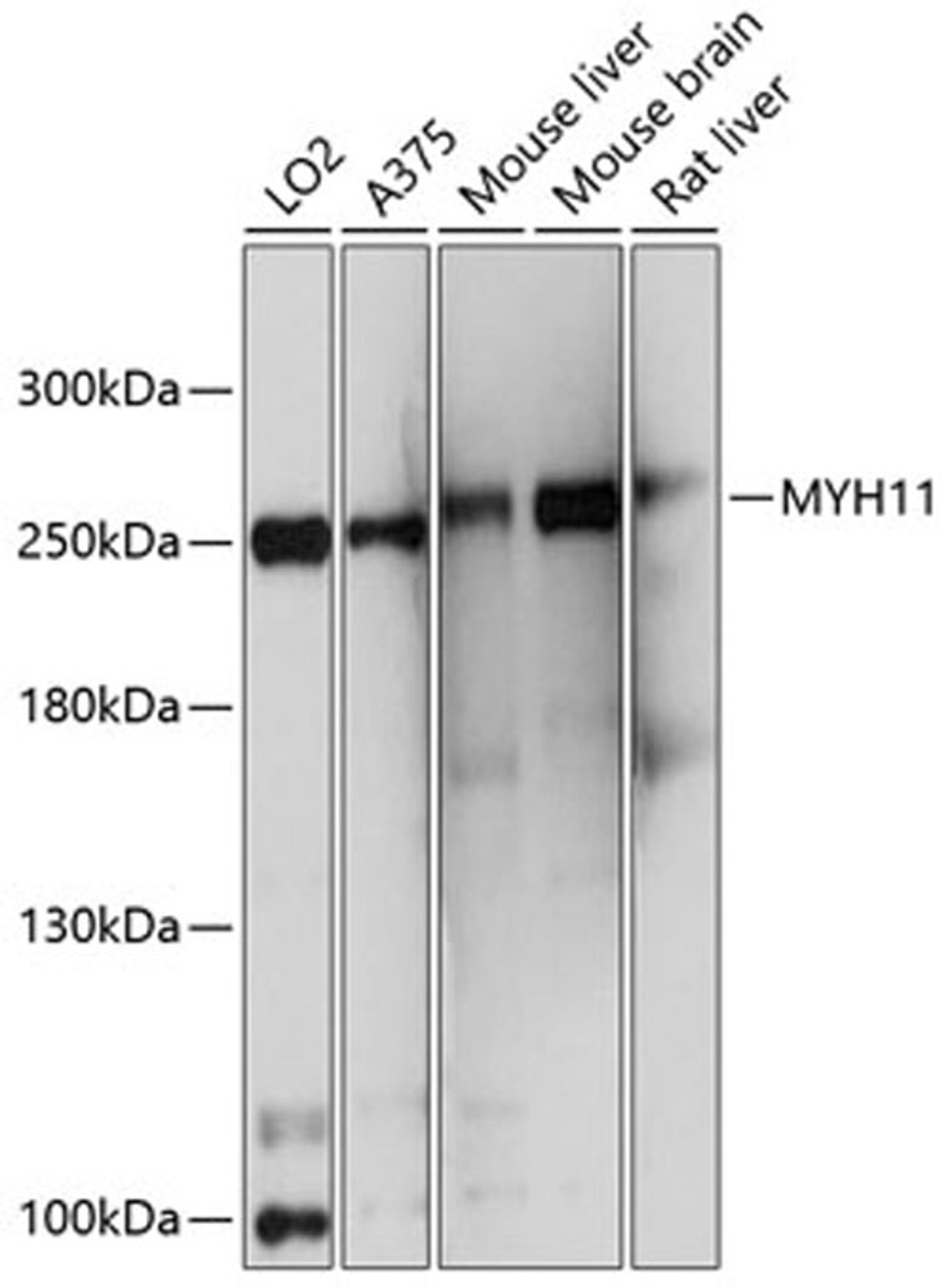 Western blot - MYH11 antibody (A10827)