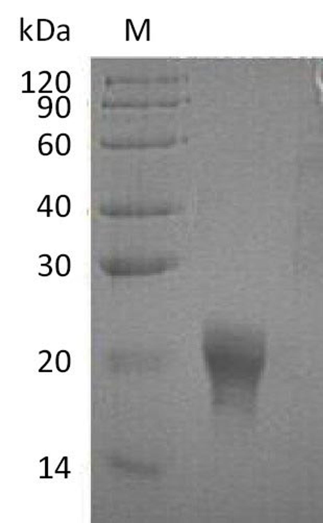 (Tris-Glycine gel) Discontinuous SDS-PAGE (reduced) with 5% enrichment gel and 15% separation gel.