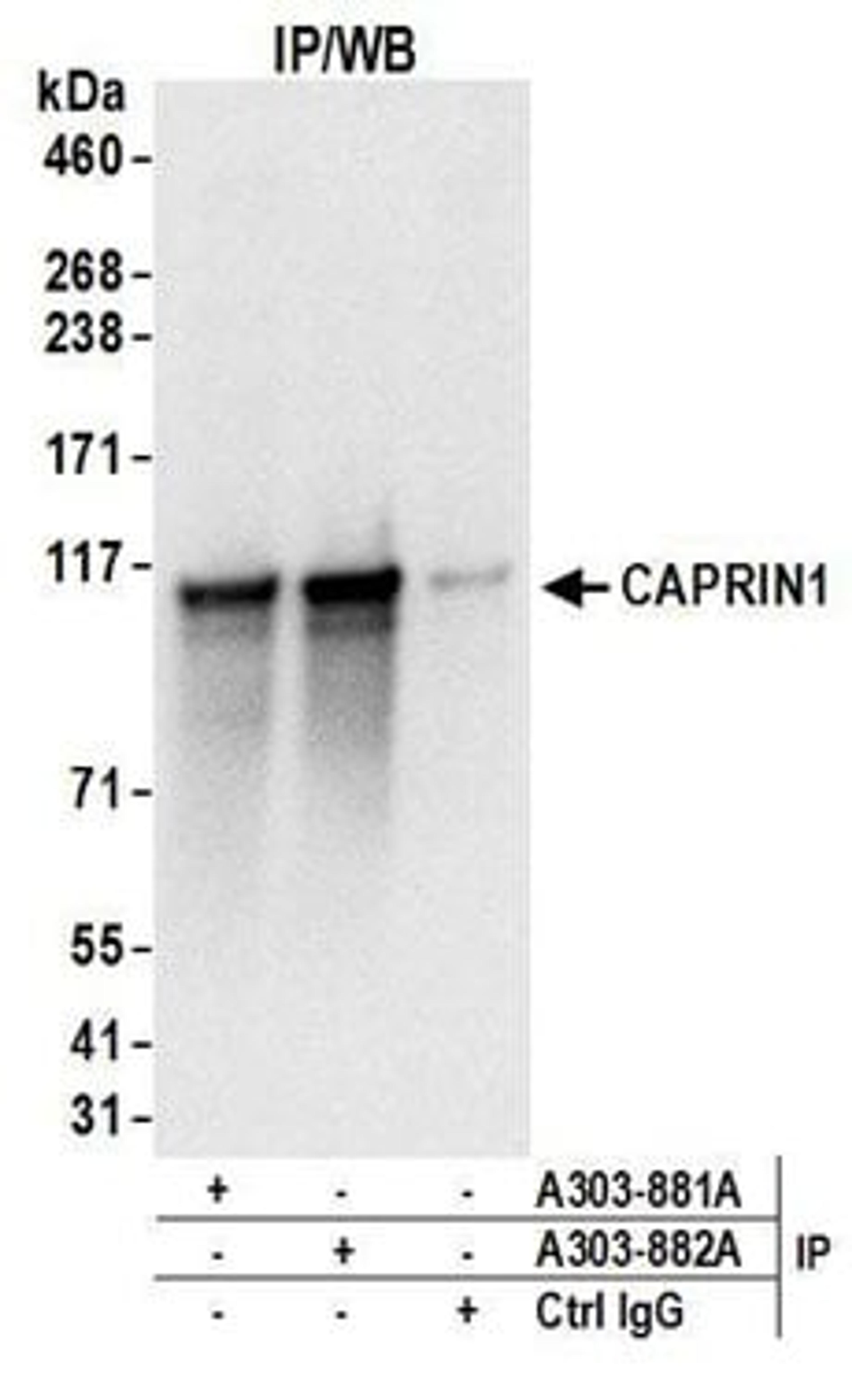 Detection of human CAPRIN1 by western blot of immunoprecipitates.