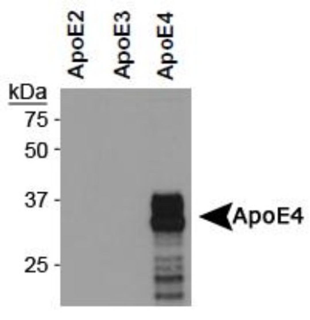 Western Blot: ApoE4 Antibody (4E4) [NBP1-49529] - Analysis of ApoE4 expression in concentrated supernatants of CHO cells secreting human ApoE2, ApoE3 or ApoE4 using NBP1-49529.  Image courtesy of Dr. Marko Roblek from the Medical University of Vienna.