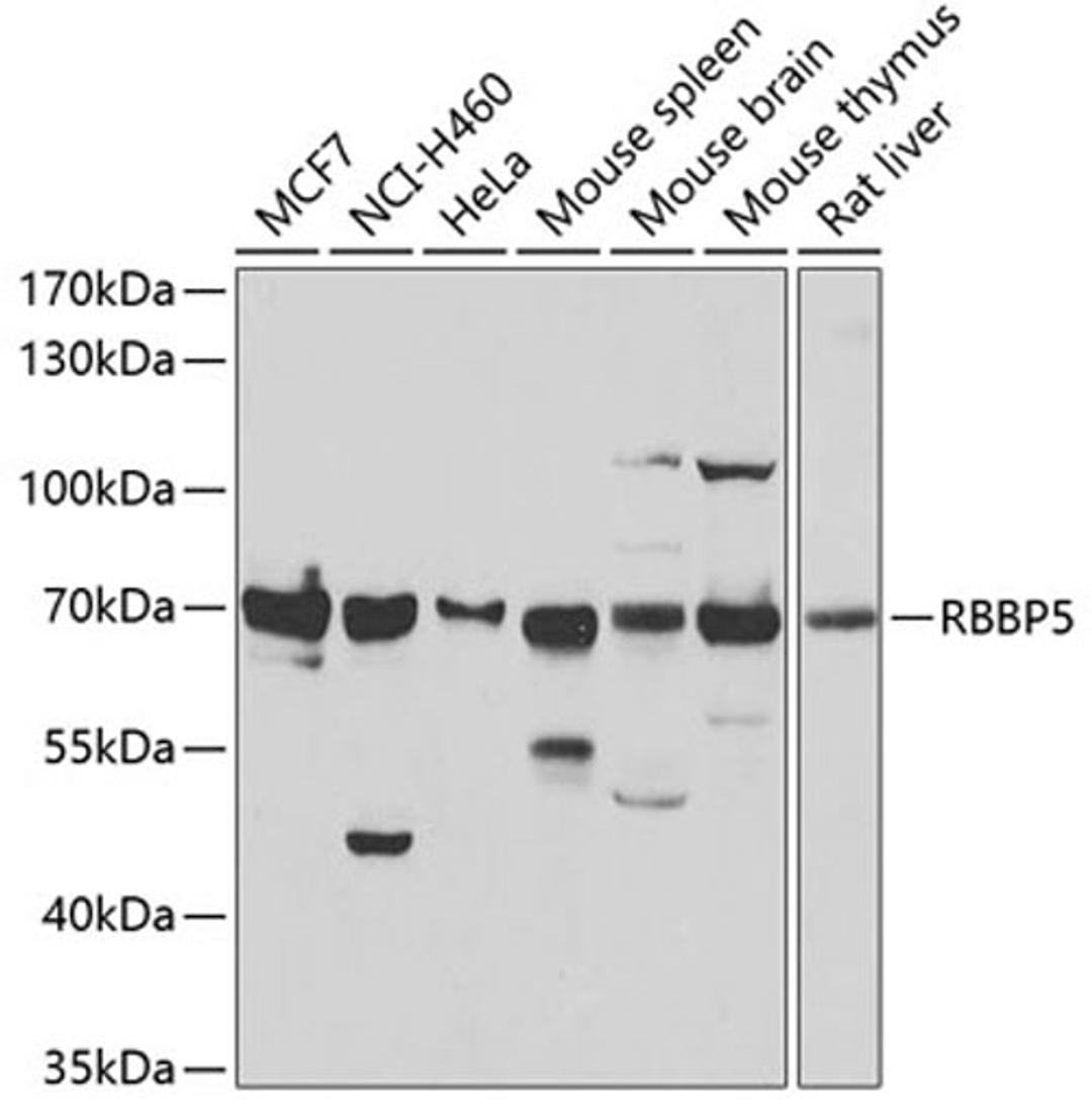 Western blot - RBBP5 antibody (A6965)