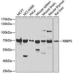 Western blot - RBBP5 antibody (A6965)