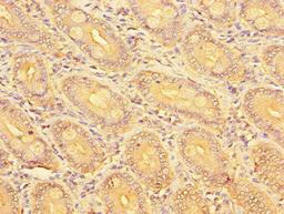 Immunohistochemistry of paraffin-embedded human small intestine tissue using CSB-PA768212LA01HU at dilution of 1:100