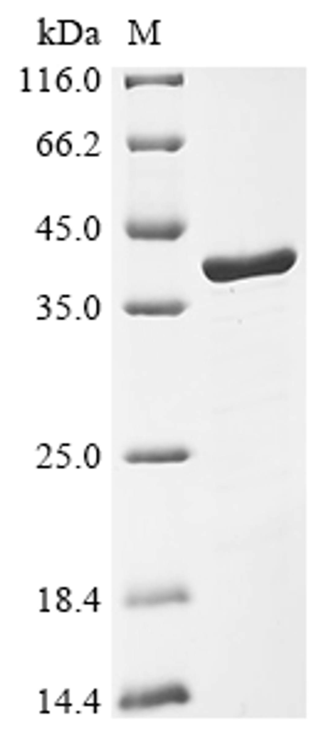 (Tris-Glycine gel) Discontinuous SDS-PAGE (reduced) with 5% enrichment gel and 15% separation gel.
