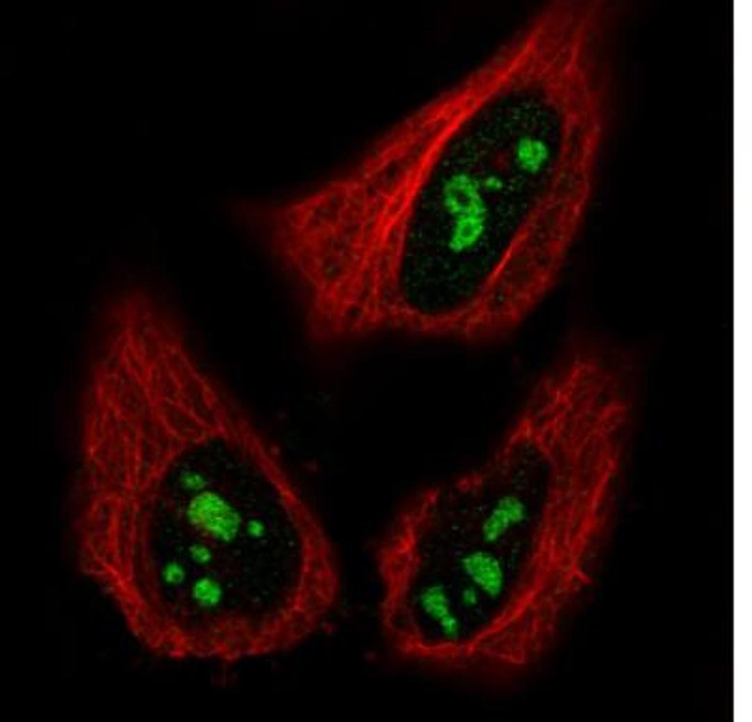 Immunocytochemistry/Immunofluorescence: NIFK Antibody (CL2240) [NBP2-36749] - Staining in HeLa cell line with Anti-MKI67IP monoclonal antibody, showing specific staining of nucleoli in green. Microtubule- and nuclear probes are visualized in red and blue respectively (where available). Antibody staining is shown in green.