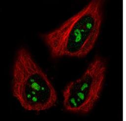 Immunocytochemistry/Immunofluorescence: NIFK Antibody (CL2240) [NBP2-36749] - Staining in HeLa cell line with Anti-MKI67IP monoclonal antibody, showing specific staining of nucleoli in green. Microtubule- and nuclear probes are visualized in red and blue respectively (where available). Antibody staining is shown in green.