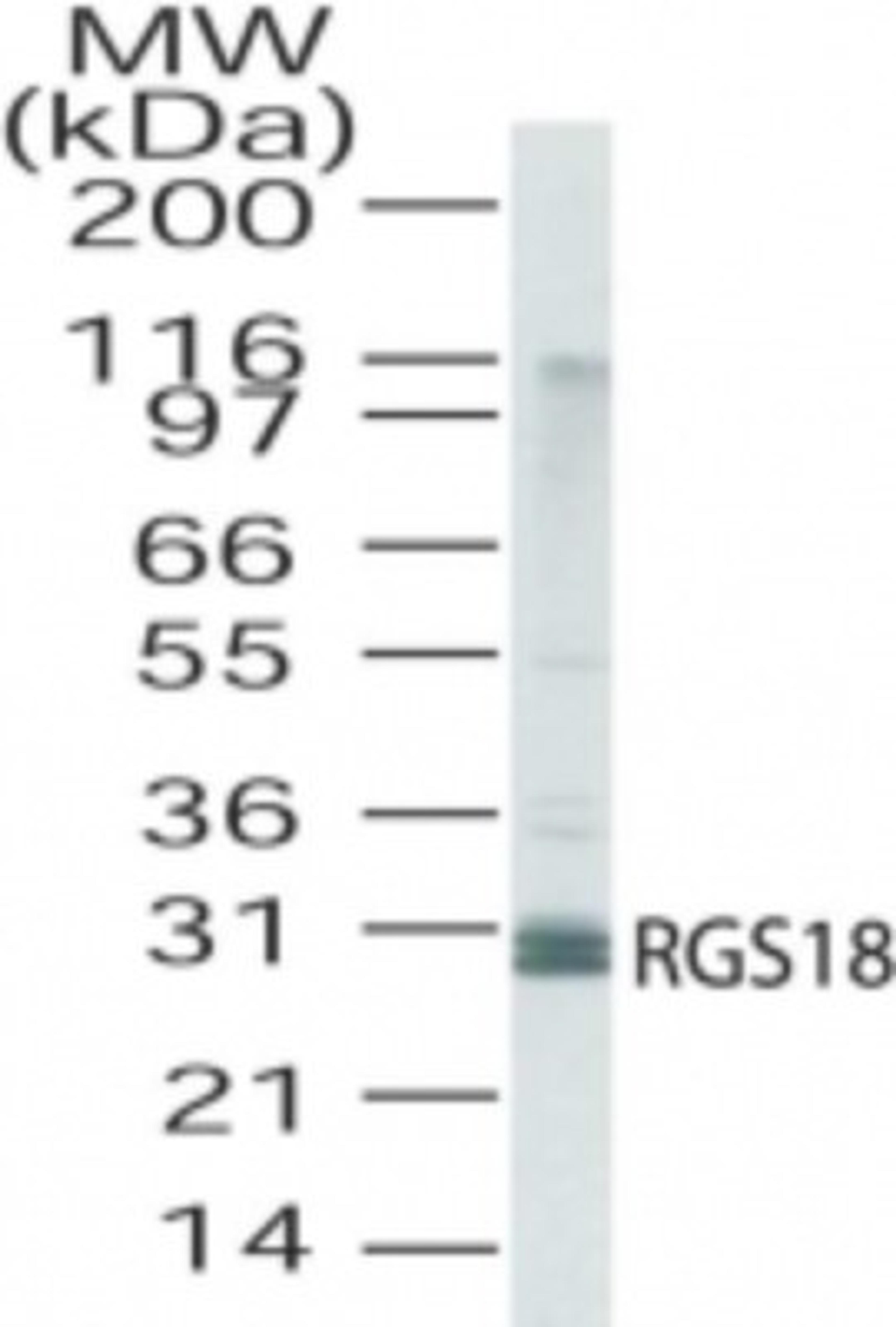 Western Blot: RGS18 Antibody [NB100-56734] - Analysis of RGS18 in human lung lysate using this antibody at a dilution of 2 ug/ml.