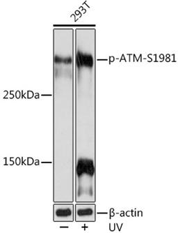 Western blot - Phospho-ATM-S1981 Rabbit mAb (AP1030)