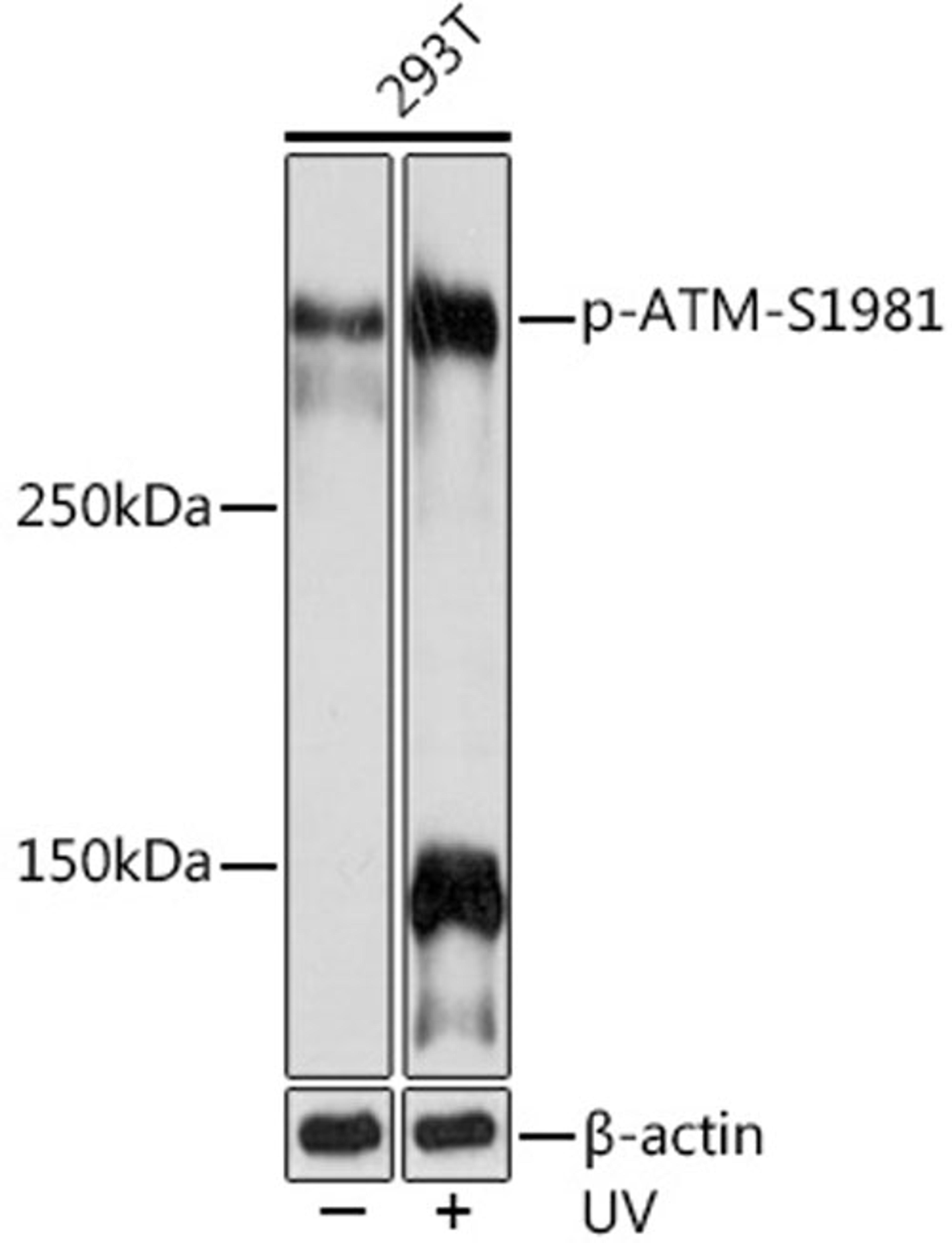 Western blot - Phospho-ATM-S1981 Rabbit mAb (AP1030)