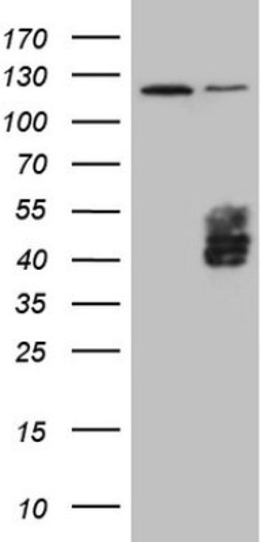 Western Blot: TFPI Antibody (5H5) [NBP2-46098] - Analysis of HEK293T cells were transfected with the pCMV6-ENTRY control (Left lane) or pCMV6-ENTRY TFPI.