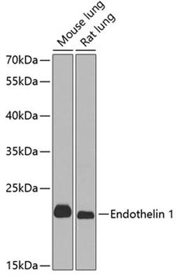 Western blot - Endothelin 1 antibody (A0686)