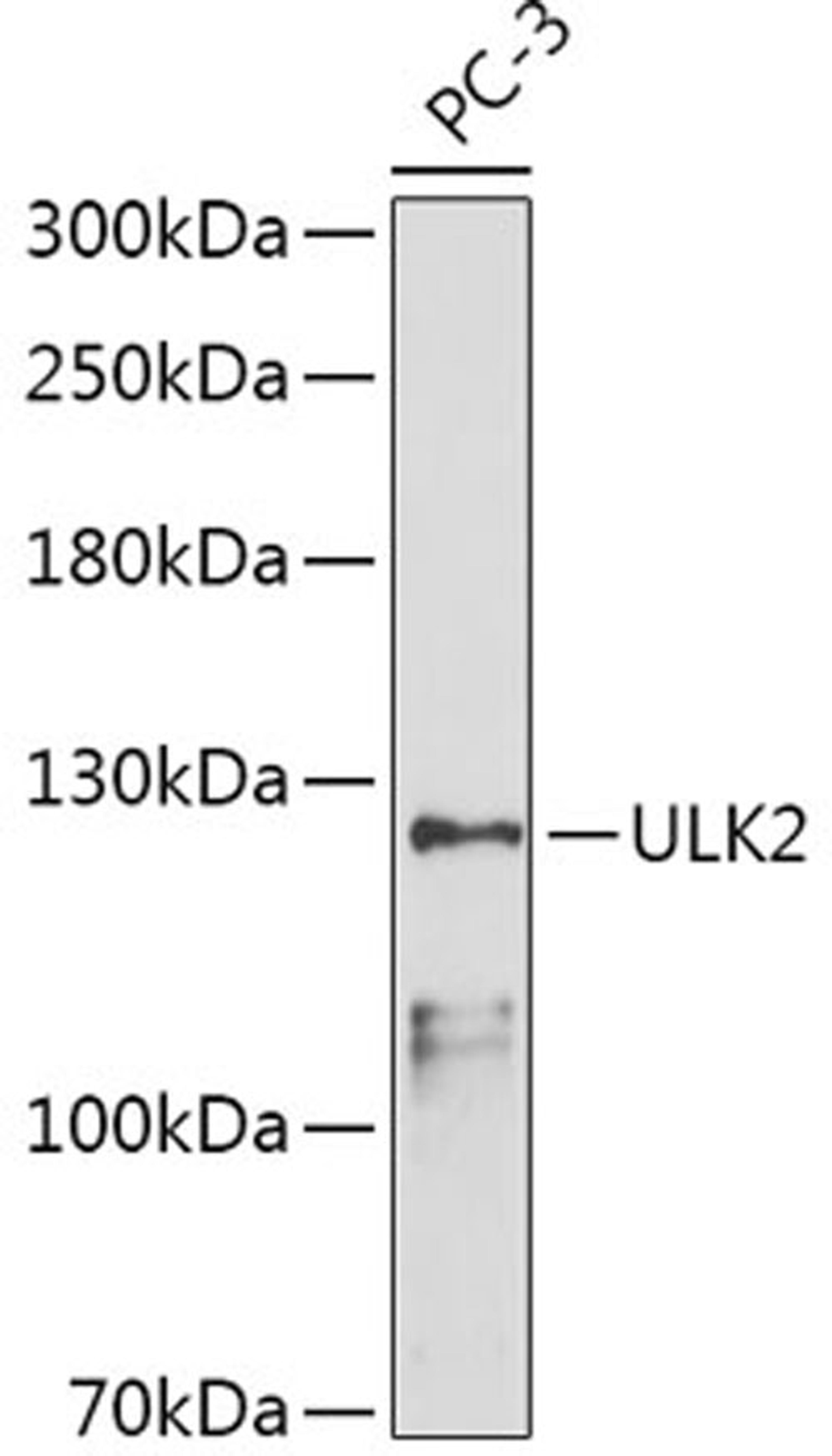 Western blot - ULK2 antibody (A15243)