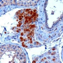 Immunohistochemistry-Paraffin: SECISBP2 Antibody [NB100-53795] - (3ug/ml) staining of paraffin embedded Human Testis. Microwaved antigen retrieval with Tris/EDTA buffer pH9, HRP-staining.