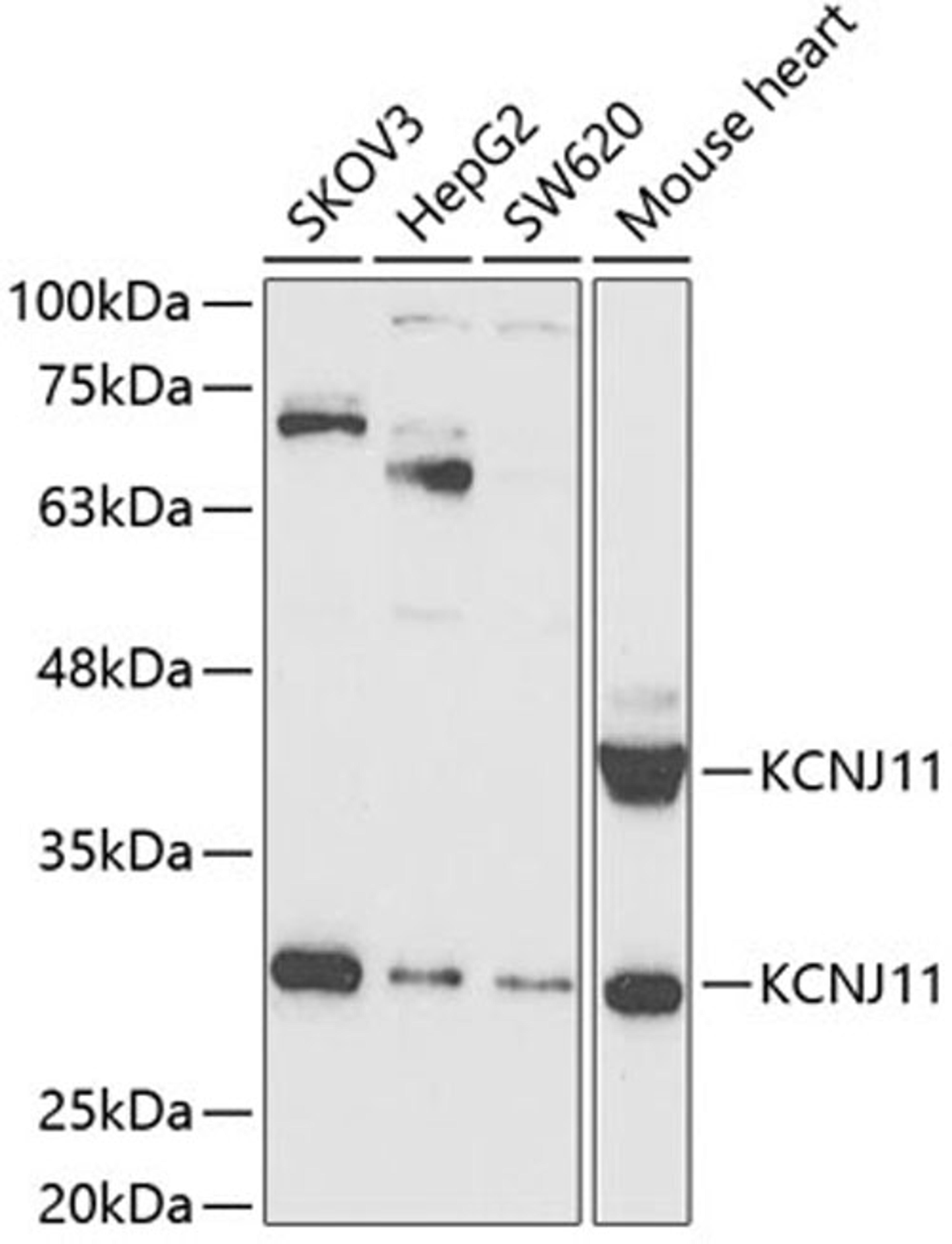 Western blot - KCNJ11 antibody (A5765)