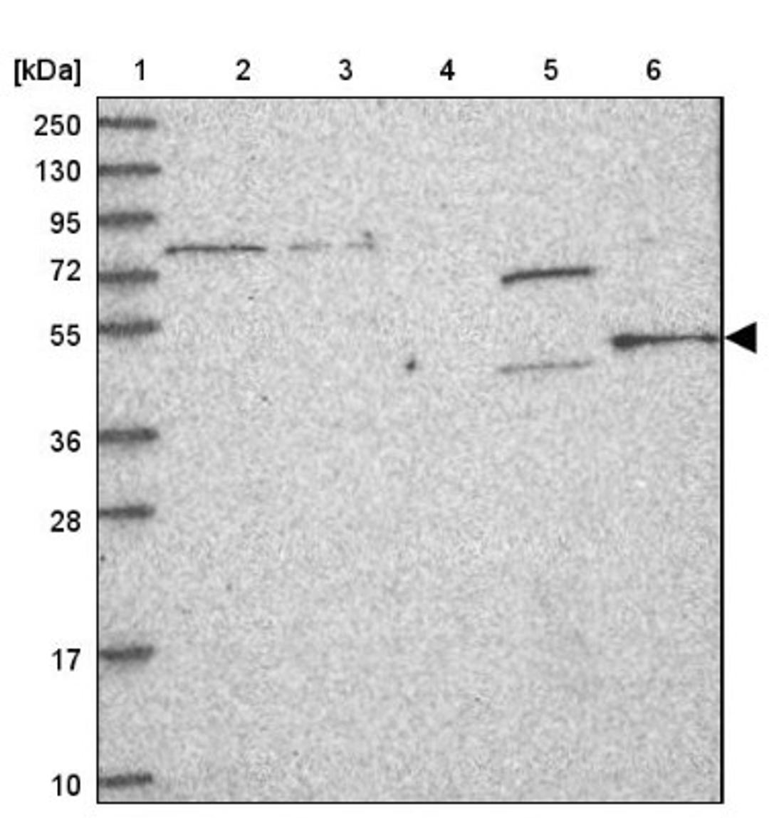 Western Blot: FAM164C Antibody [NBP2-47462] - Lane 1: Marker [kDa] 250, 130, 95, 72, 55, 36, 28, 17, 10.  Lane 2: Human cell line RT-4.  Lane 3: Human cell line U-251MG.  Lane 4: Human plasma (IgG/HSA depleted).  Lane 5: Human liver tissue.  Lane 6: Human tonsil tissue.