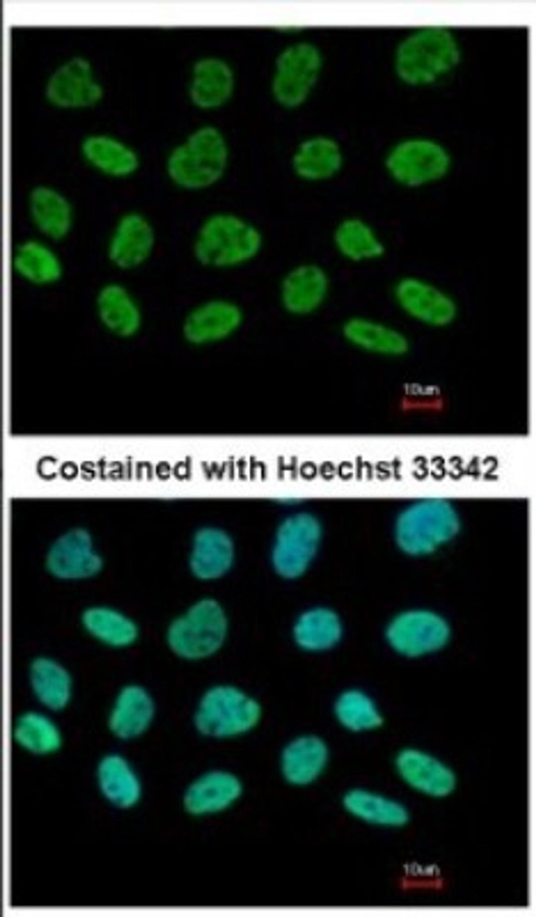 Immunocytochemistry/Immunofluorescence: DIP13B Antibody [NBP2-16164] - Immunofluorescence analysis of paraformaldehyde-fixed A431, using antibody at 1:500 dilution.