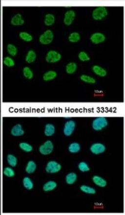 Immunocytochemistry/Immunofluorescence: DIP13B Antibody [NBP2-16164] - Immunofluorescence analysis of paraformaldehyde-fixed A431, using antibody at 1:500 dilution.