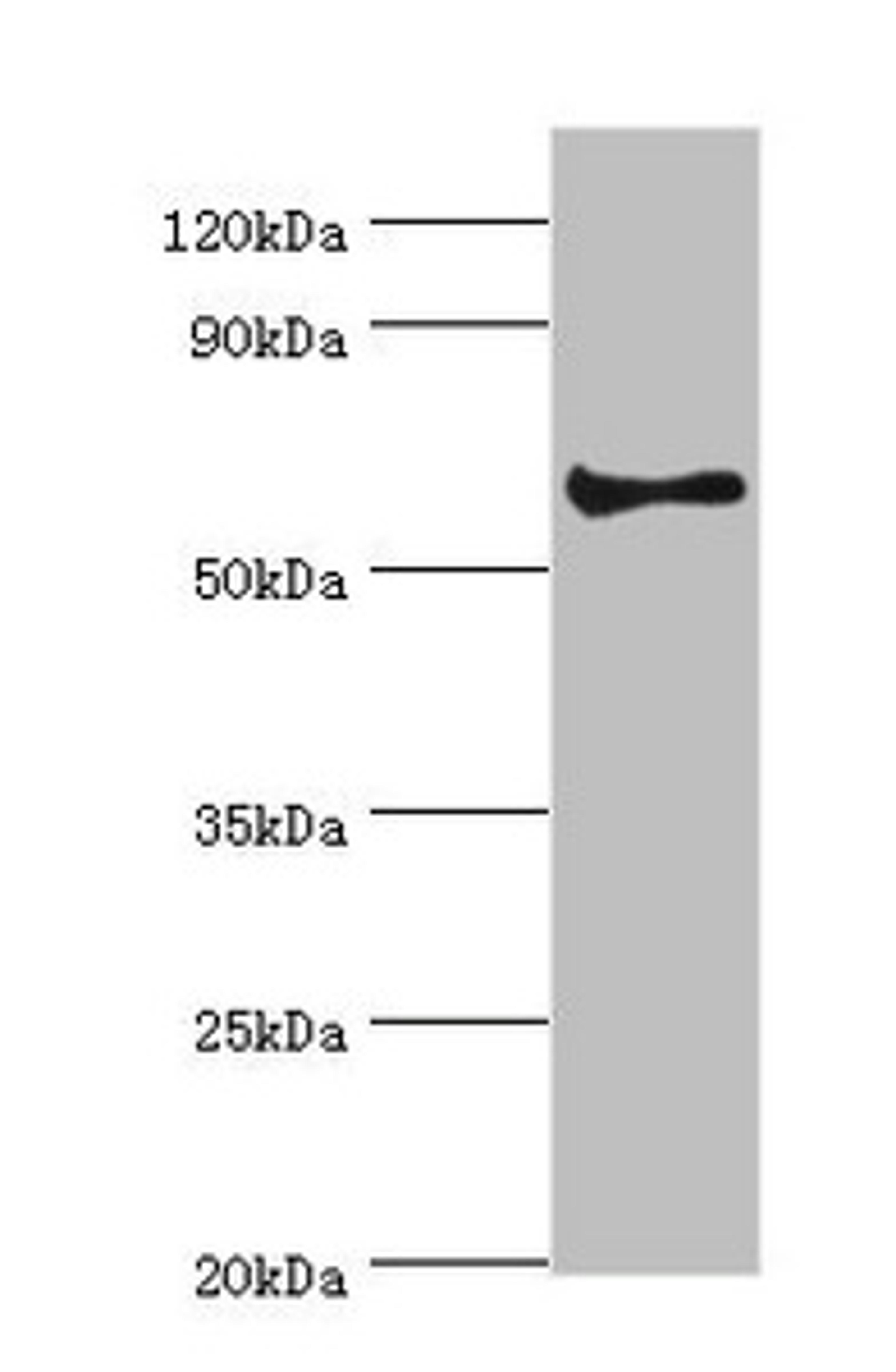 Western blot. All lanes: Muscarinic acetylcholine receptor M3 antibody at 2ug/ml + Hela whole cell lysate. Secondary. Goat polyclonal to rabbit IgG at 1/10000 dilution. Predicted band size: 66 kDa. Observed band size: 66 kDa. 