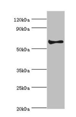 Western blot. All lanes: Muscarinic acetylcholine receptor M3 antibody at 2ug/ml + Hela whole cell lysate. Secondary. Goat polyclonal to rabbit IgG at 1/10000 dilution. Predicted band size: 66 kDa. Observed band size: 66 kDa.