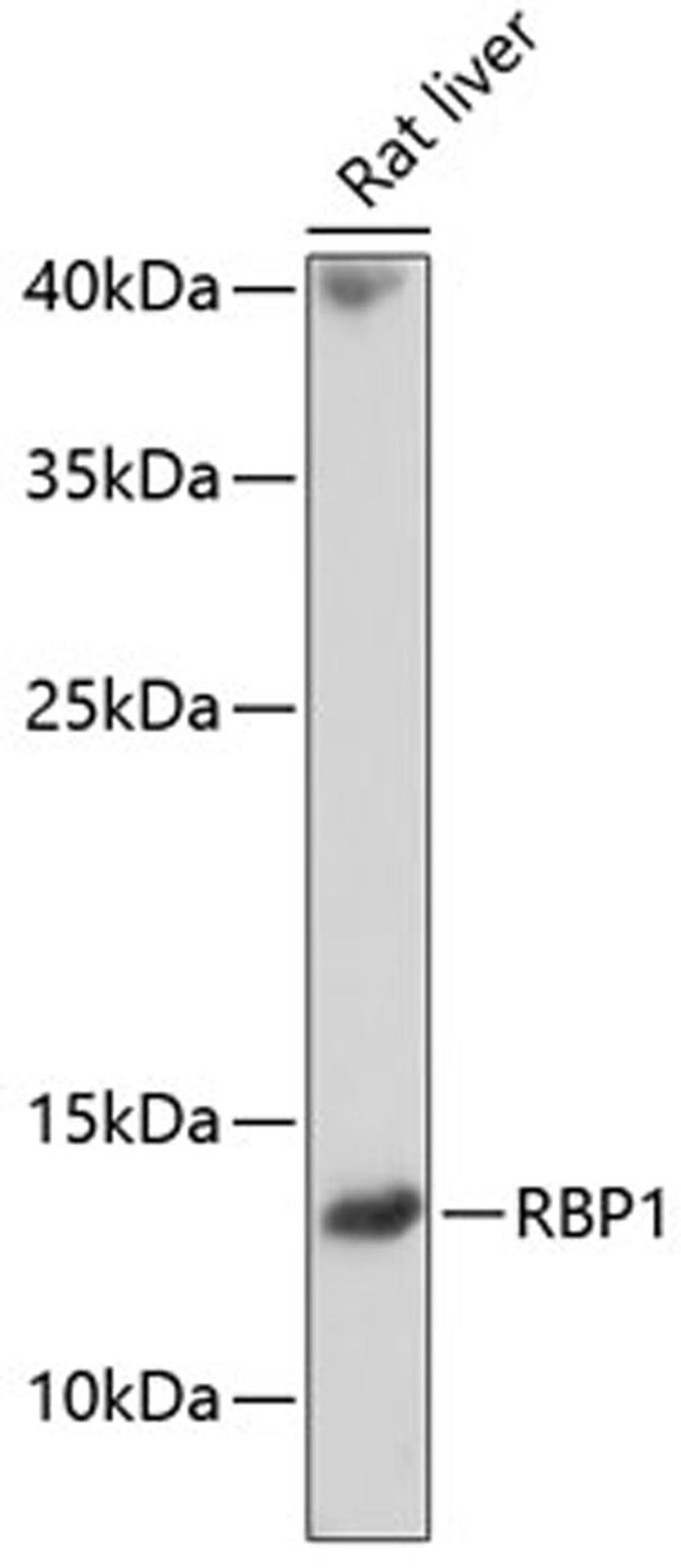 Western blot - RBP1 antibody (A10029)