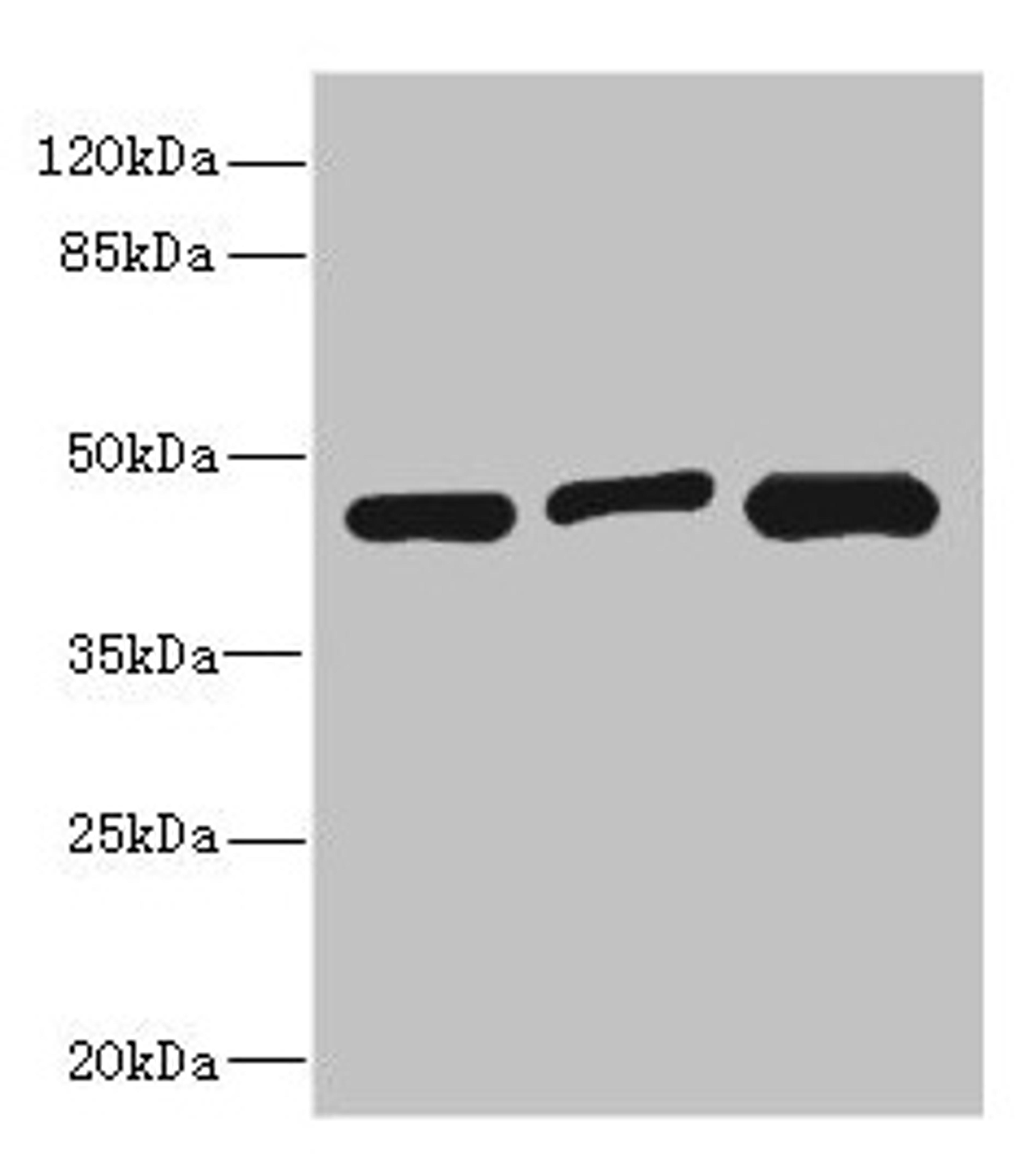 Western blot. All lanes: ITPK1 antibody at 3.58µg/ml. Lane 1: Hela whole cell lysate. Lane 2: HepG2 whole cell lysate. Lane 3: A431 whole cell lysate. Secondary. Goat polyclonal to rabbit IgG at 1/10000 dilution. Predicted band size: 46, 36 kDa. Observed band size: 46 kDa