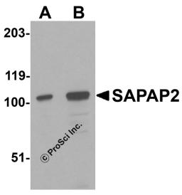 Western blot analysis of SAPAP2 in Raji cell lysate with SAPAP2 antibody at (A) 0.5 and (B) 1 &#956;g/mL.