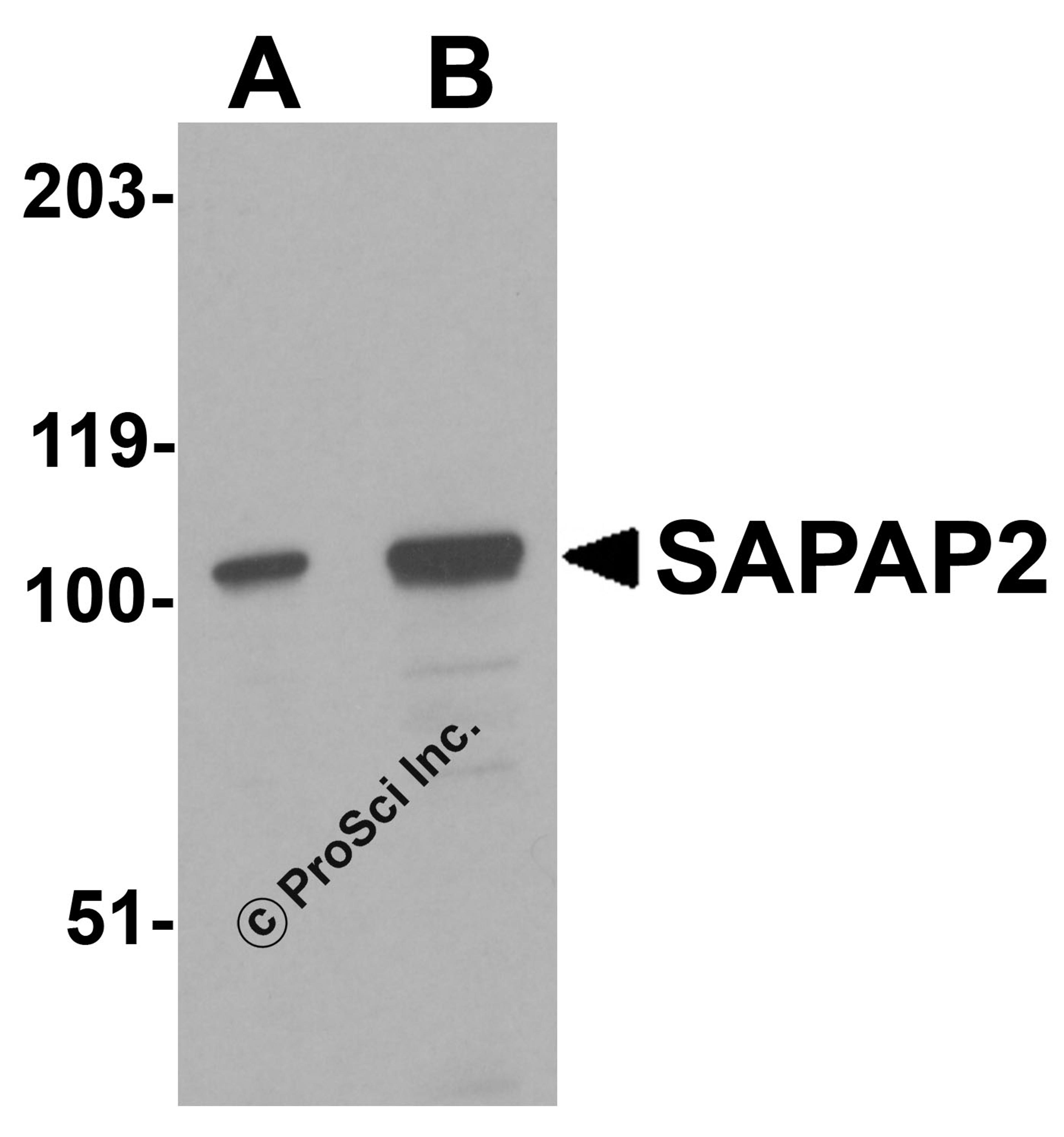 Western blot analysis of SAPAP2 in Raji cell lysate with SAPAP2 antibody at (A) 0.5 and (B) 1 μg/mL.