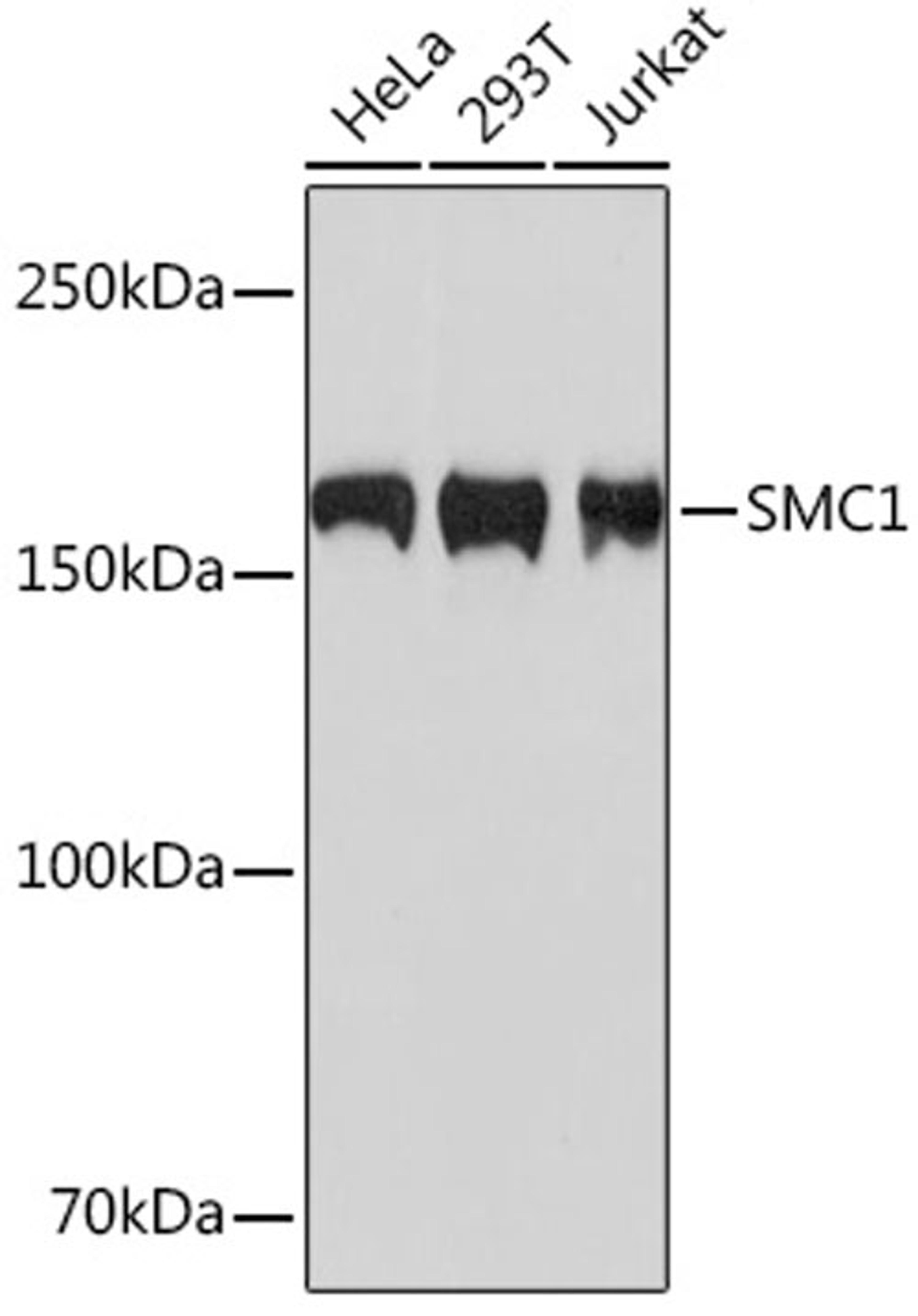 Western blot - SMC1 Rabbit mAb (A4693)