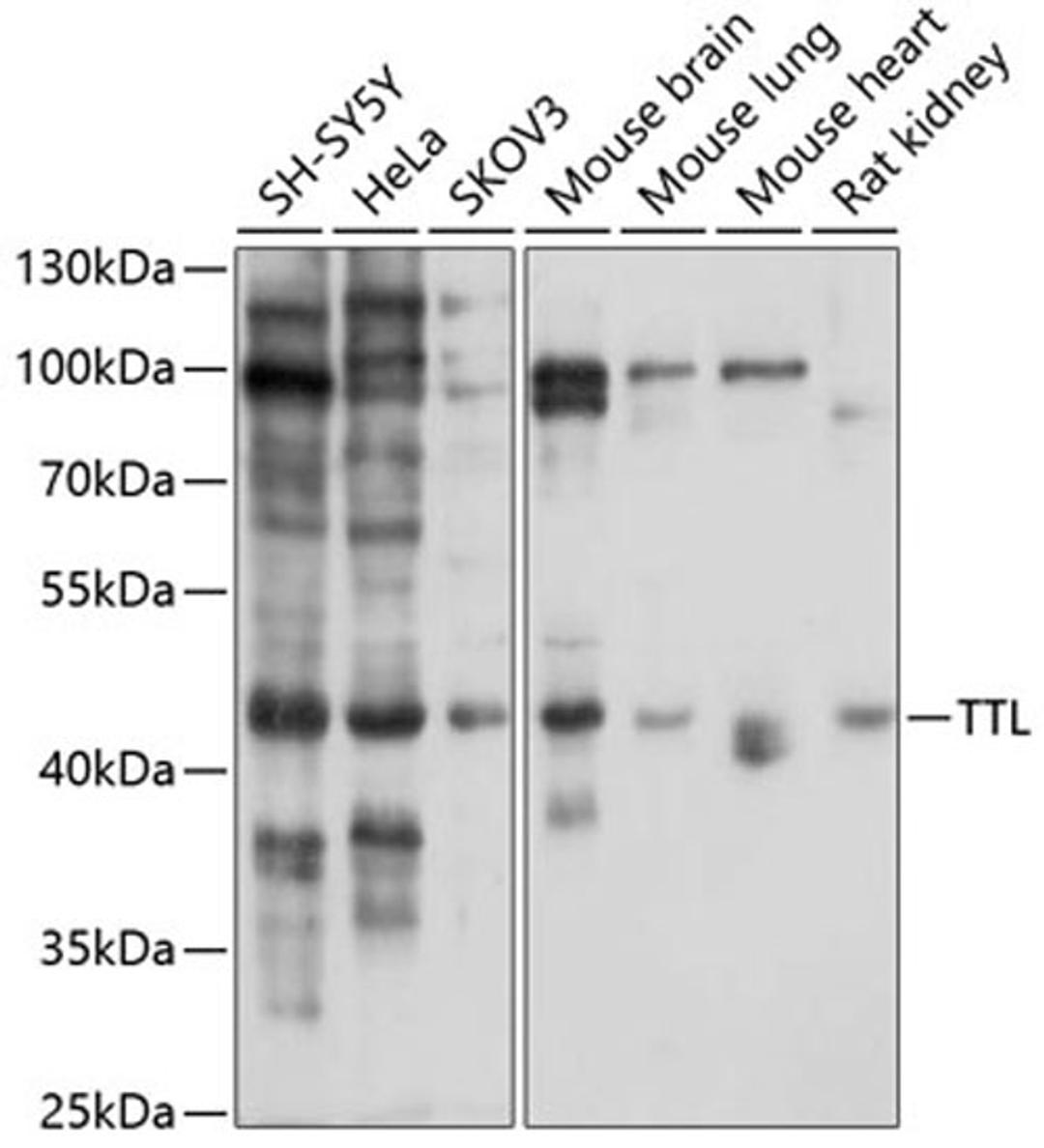 Western blot - TTL antibody (A10027)