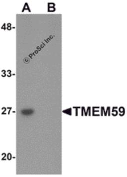 Western blot analysis of TMEM59 in human kidney tissue lysate with TMEM59 antibody at 1 μg/mL in (A) the absence and (B) the presence of blocking peptide.