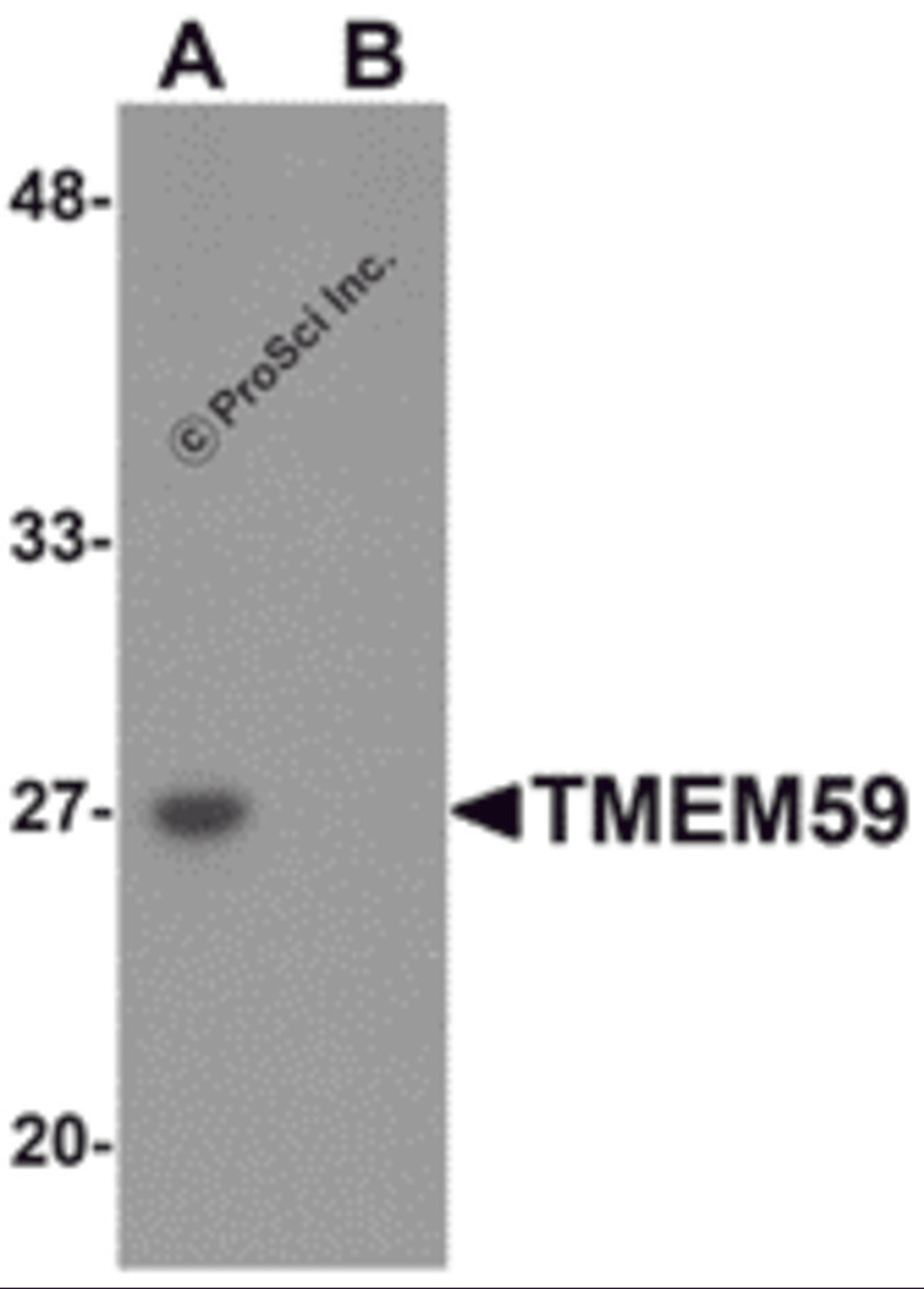 Western blot analysis of TMEM59 in human kidney tissue lysate with TMEM59 antibody at 1 μg/mL in (A) the absence and (B) the presence of blocking peptide.