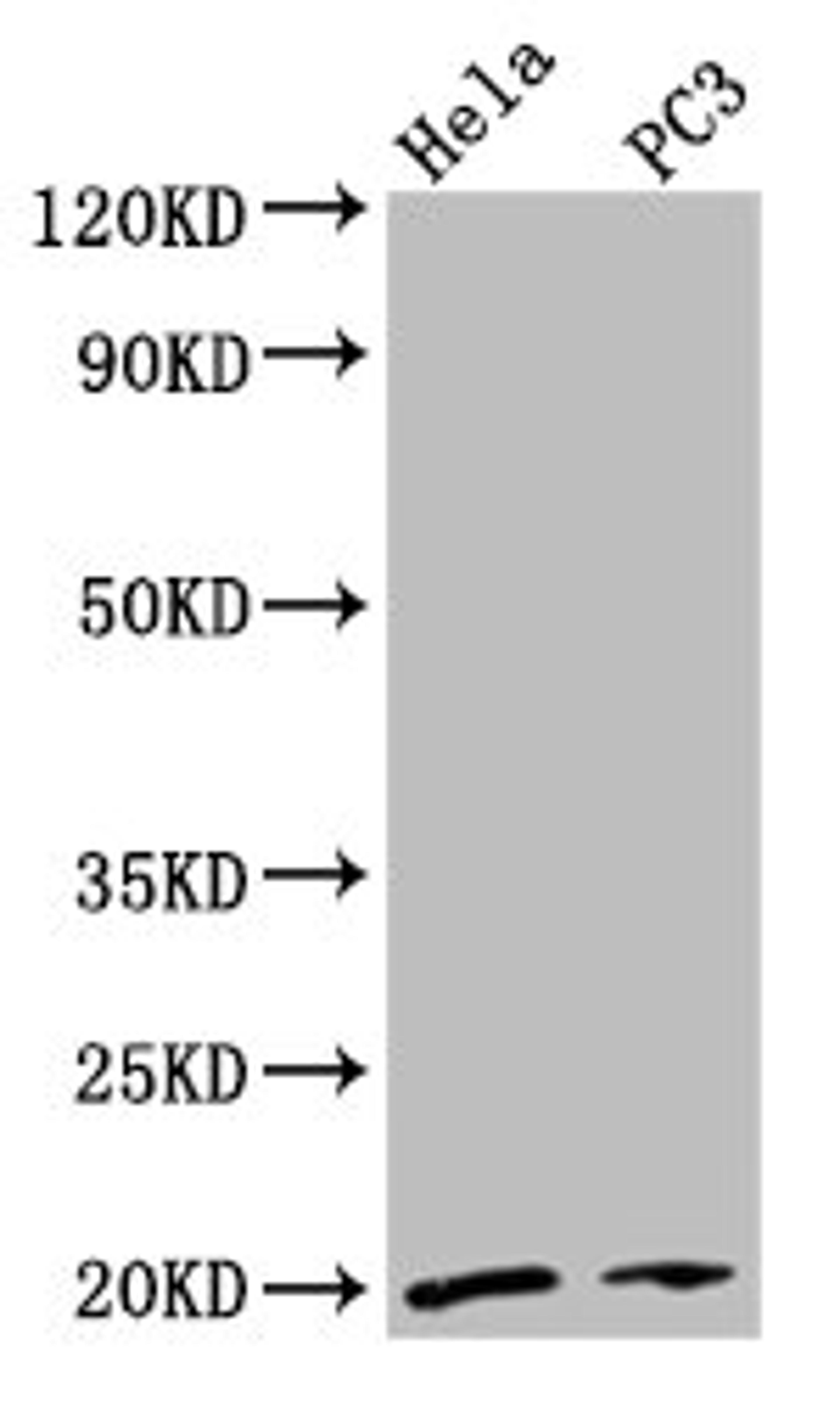 Western Blot. Positive WB detected in: Hela whole cell lysate, PC-3 whole cell lysate. All lanes: NDUFAF2 antibody at 2.7µg/ml. Secondary. Goat polyclonal to rabbit IgG at 1/50000 dilution. Predicted band size: 20 kDa. Observed band size: 20 kDa