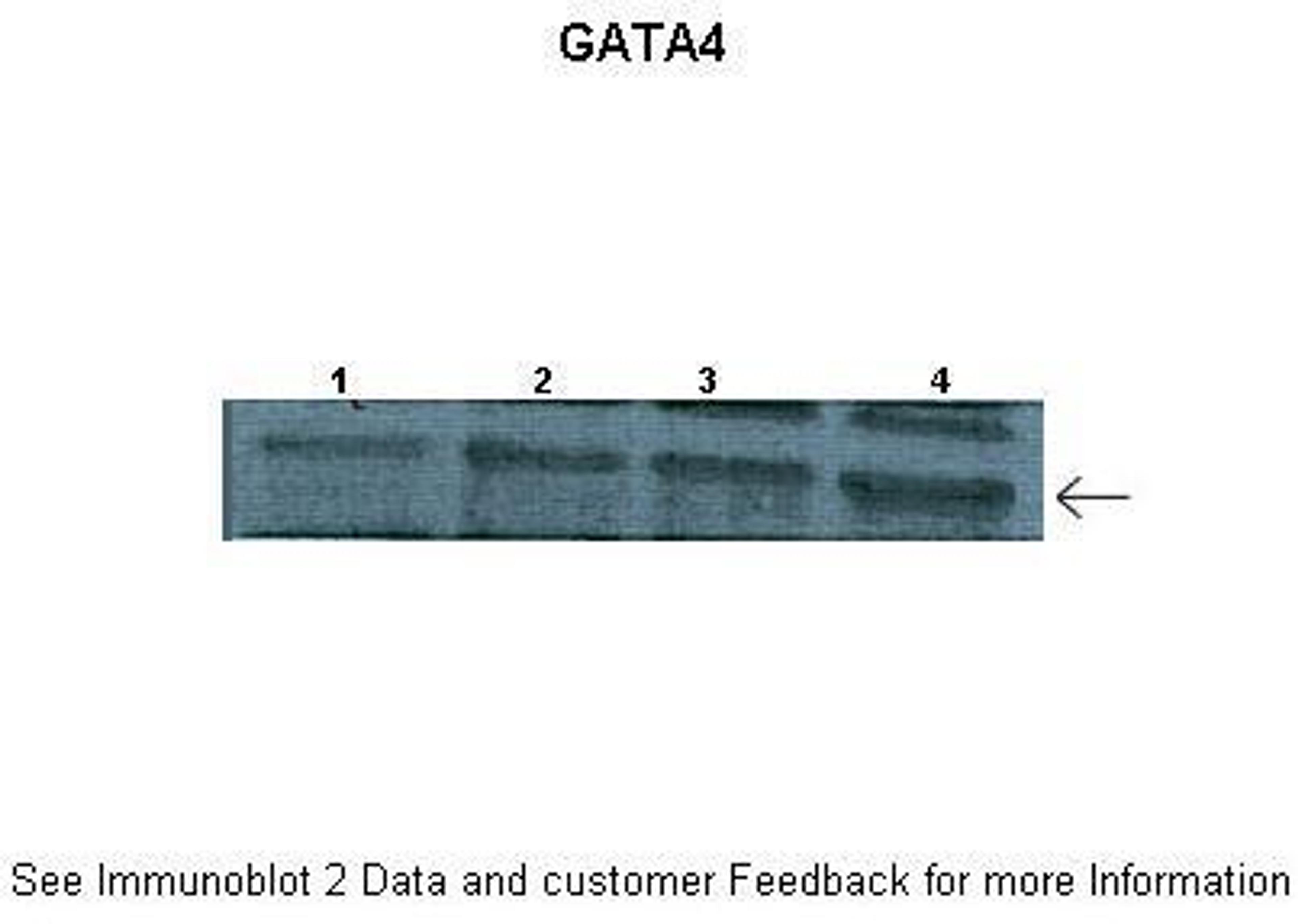 Antibody used in WB on Mouse tumor at: 1:1000 (Lanes: 1: 25 ug mouse tumor + shRNA1, 2: 25 ug mouse tumor + shRNA2, 3: 25 ug mouse tumor + shRNA3 4: 25 ug mouse tumor lysate).