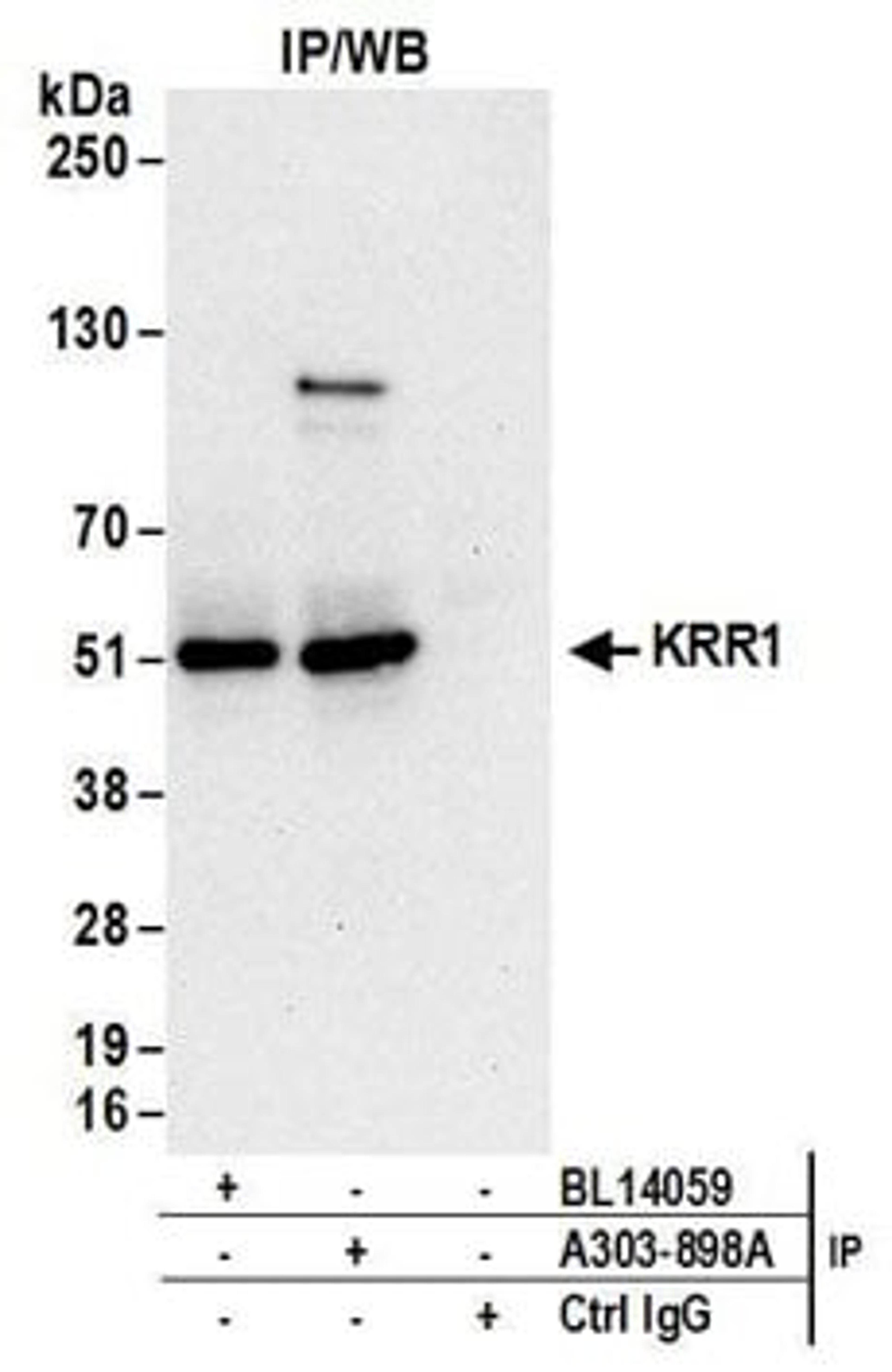 Detection of human KRR1 by western blot of immunoprecipitates.