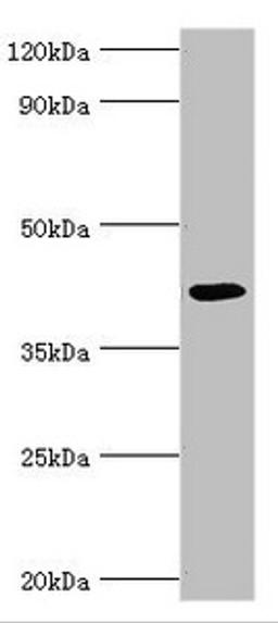 Western blot. All lanes: Alkylated DNA repair protein alkB homolog 1 antibody at 9ug/ml + Mouse kidney tissue. Secondary. Goat polyclonal to rabbit IgG at 1/10000 dilution. Predicted band size: 44 kDa. Observed band size: 44 kDa.