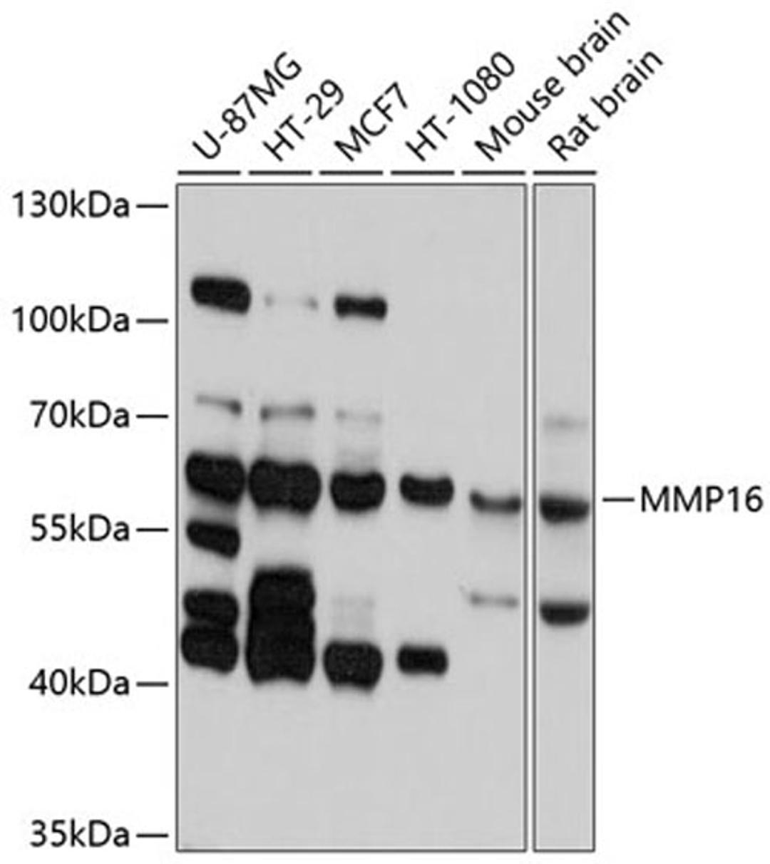 Western blot - MMP16 antibody (A10409)