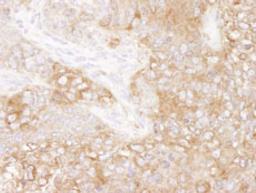 Detection of mouse eEF2 by immunohistochemistry.