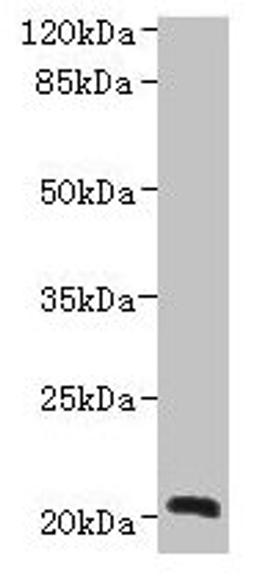 Western blot. All lanes: NICN1 antibody at 4µg/ml + U937 whole cell lysate. Secondary. Goat polyclonal to rabbit IgG at 1/10000 dilution. Predicted band size: 25, 20 kDa. Observed band size: 20 kDa