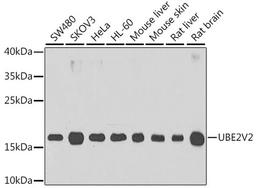 Western blot - UBE2V2 antibody (A6998)