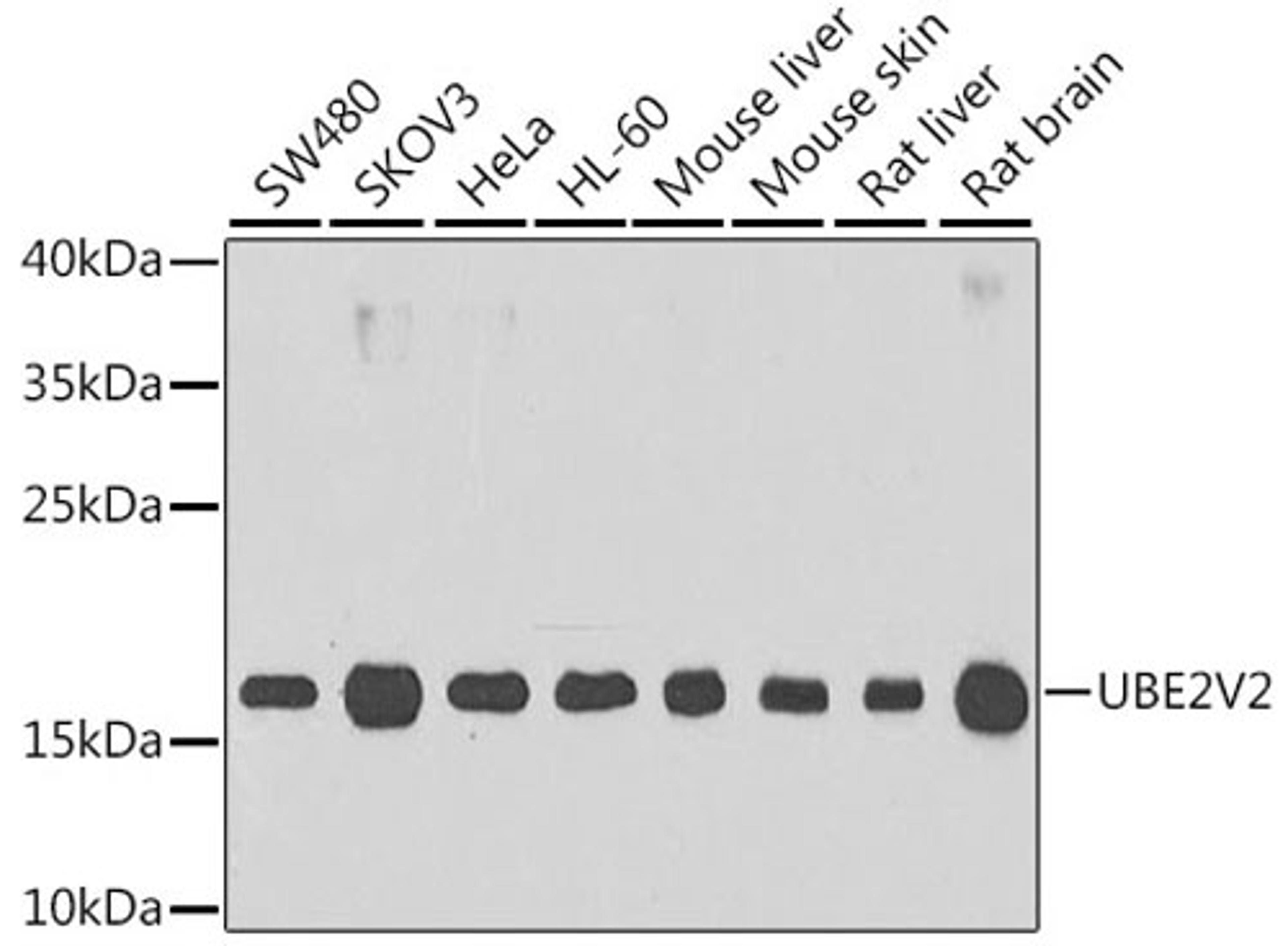 Western blot - UBE2V2 antibody (A6998)