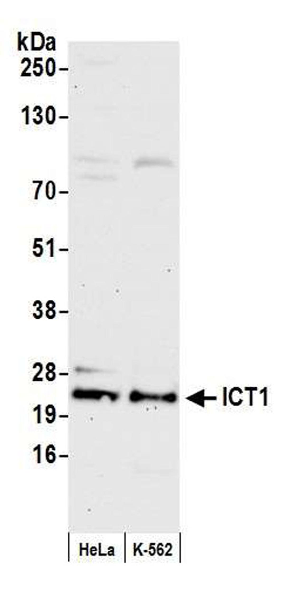 Detection of human ICT1 by WB.