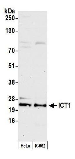 Detection of human ICT1 by WB.