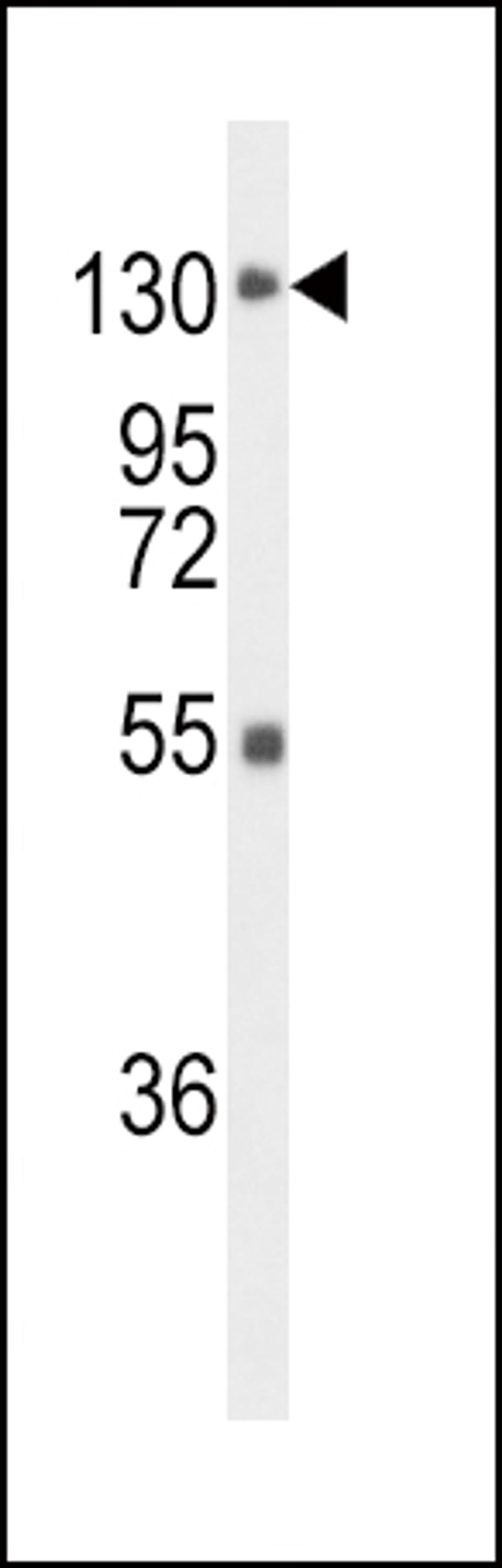 Western blot analysis of FGFR1 Antibody in mouse liver tissue lysates (35ug/lane)