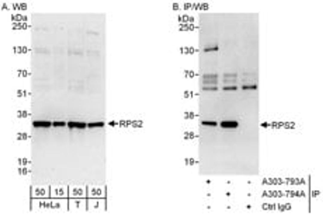 Detection of human RPS2 by western blot and immunoprecipitation.