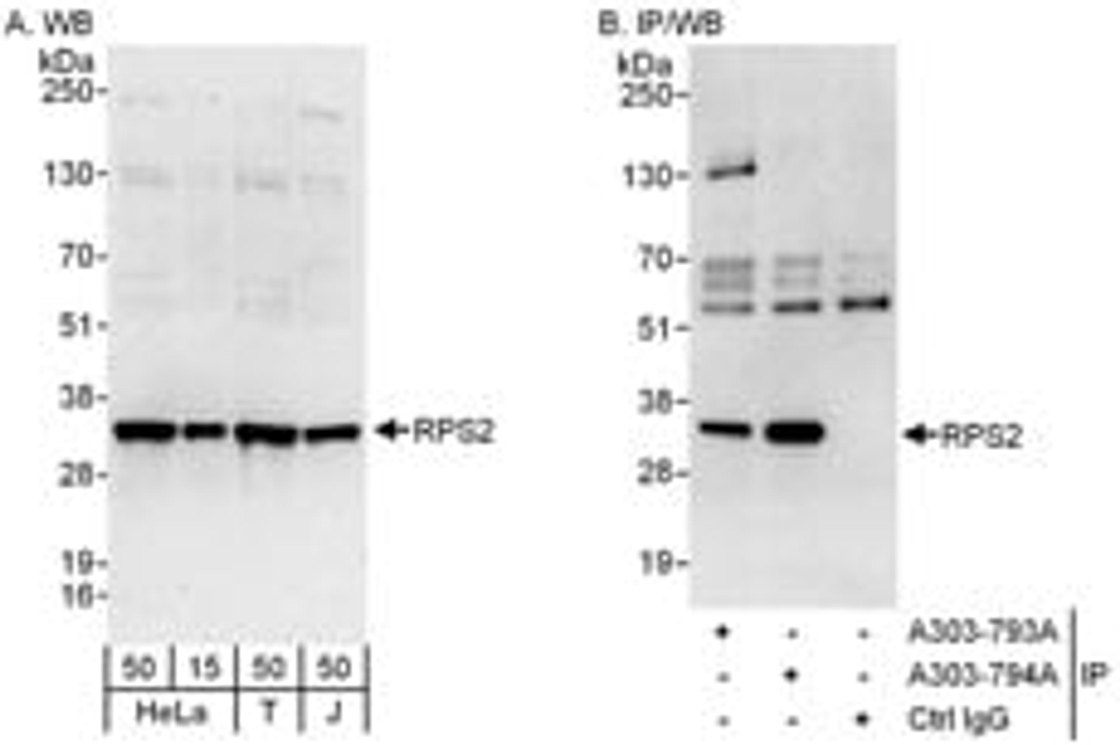 Detection of human RPS2 by western blot and immunoprecipitation.