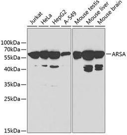 Western blot - ARSA antibody (A1736)