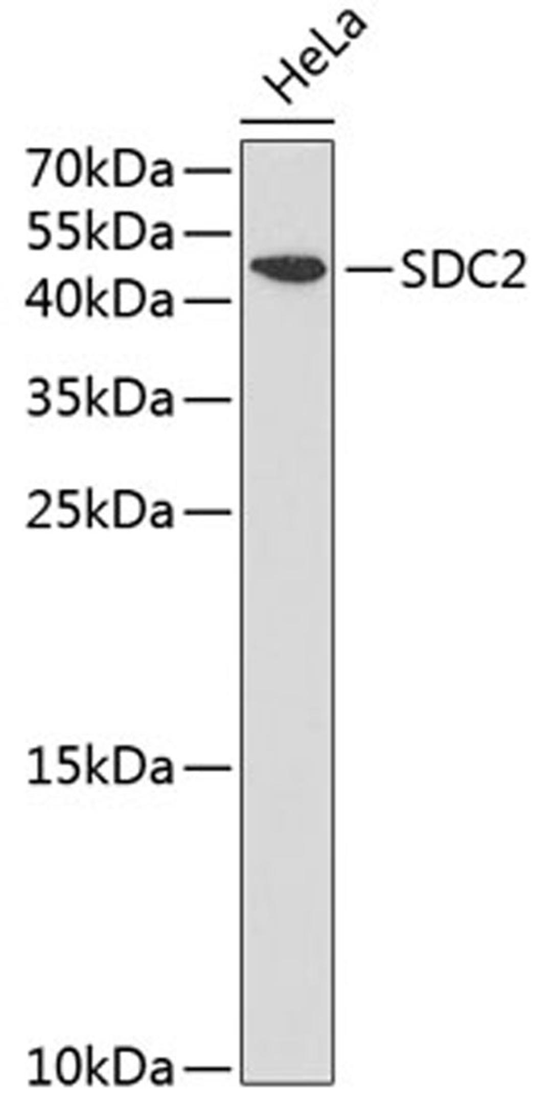 Western blot - SDC2 antibody (A1810)