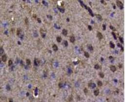 Immunohistochemical staining of mouse heart tissue using VCP antibody