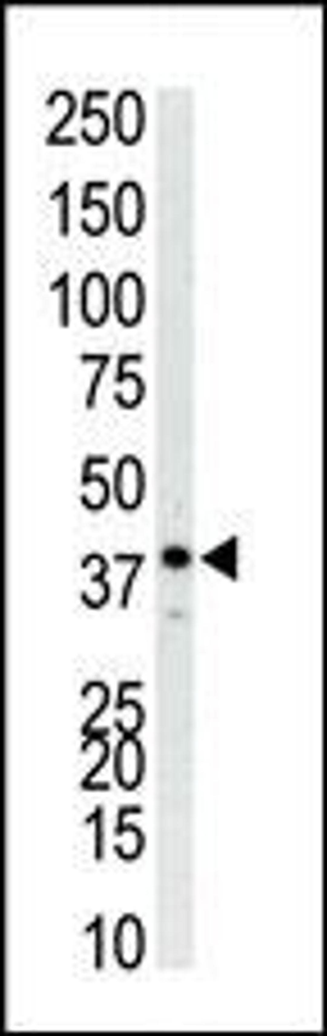 Antibody is used in Western blot to detect P38 in Jurkat cell lysate.