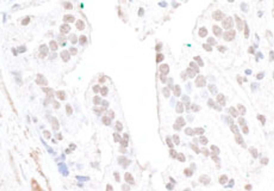 Detection of human FBW7 by immunohistochemistry.